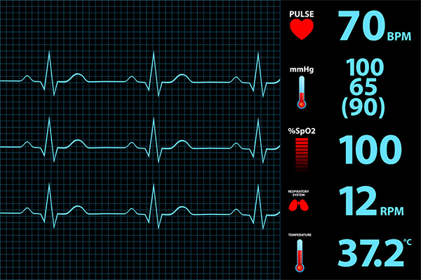 ECG